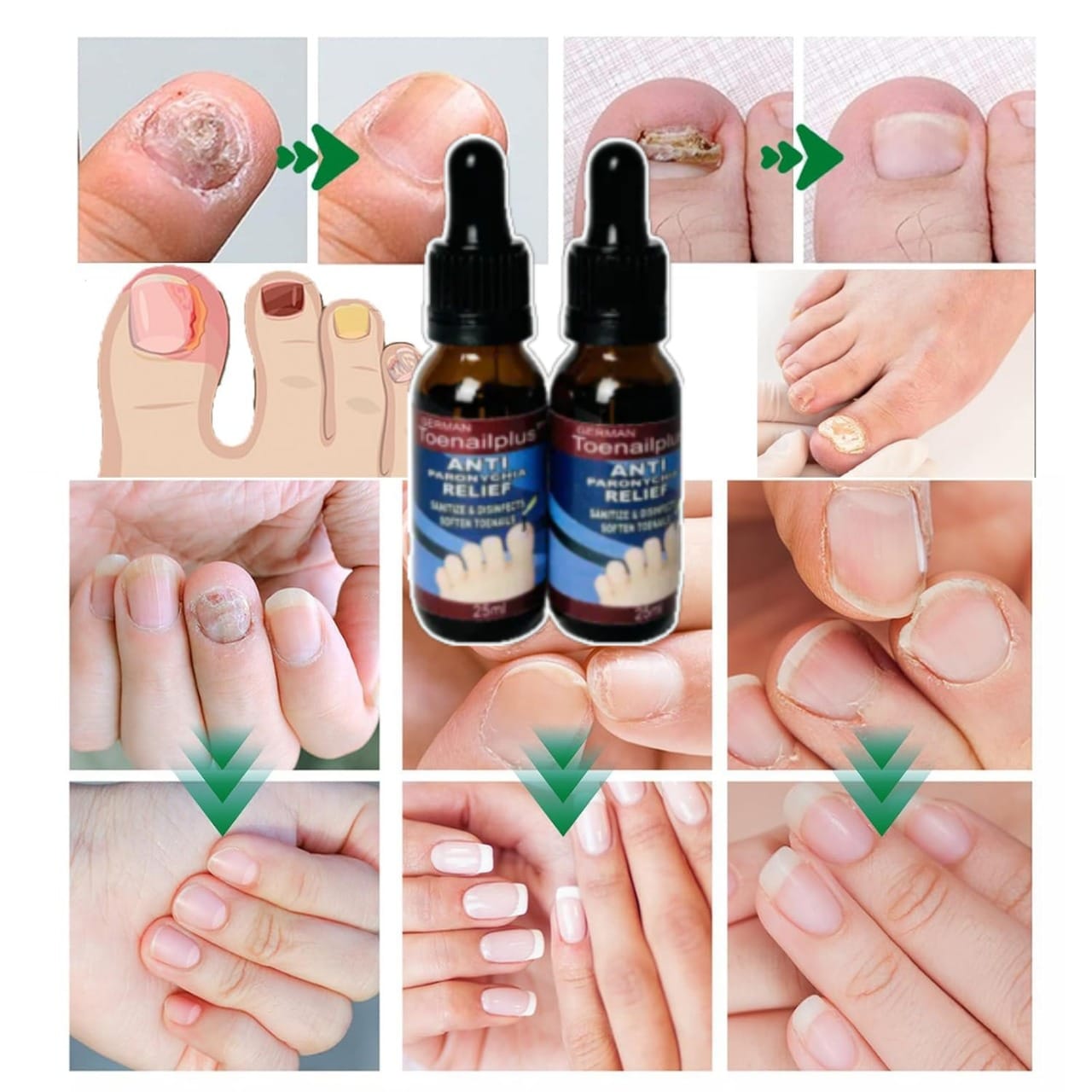 Fungifree® 2X1 SOLO POR HOY