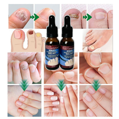 Fungifree® 2X1 SOLO POR HOY